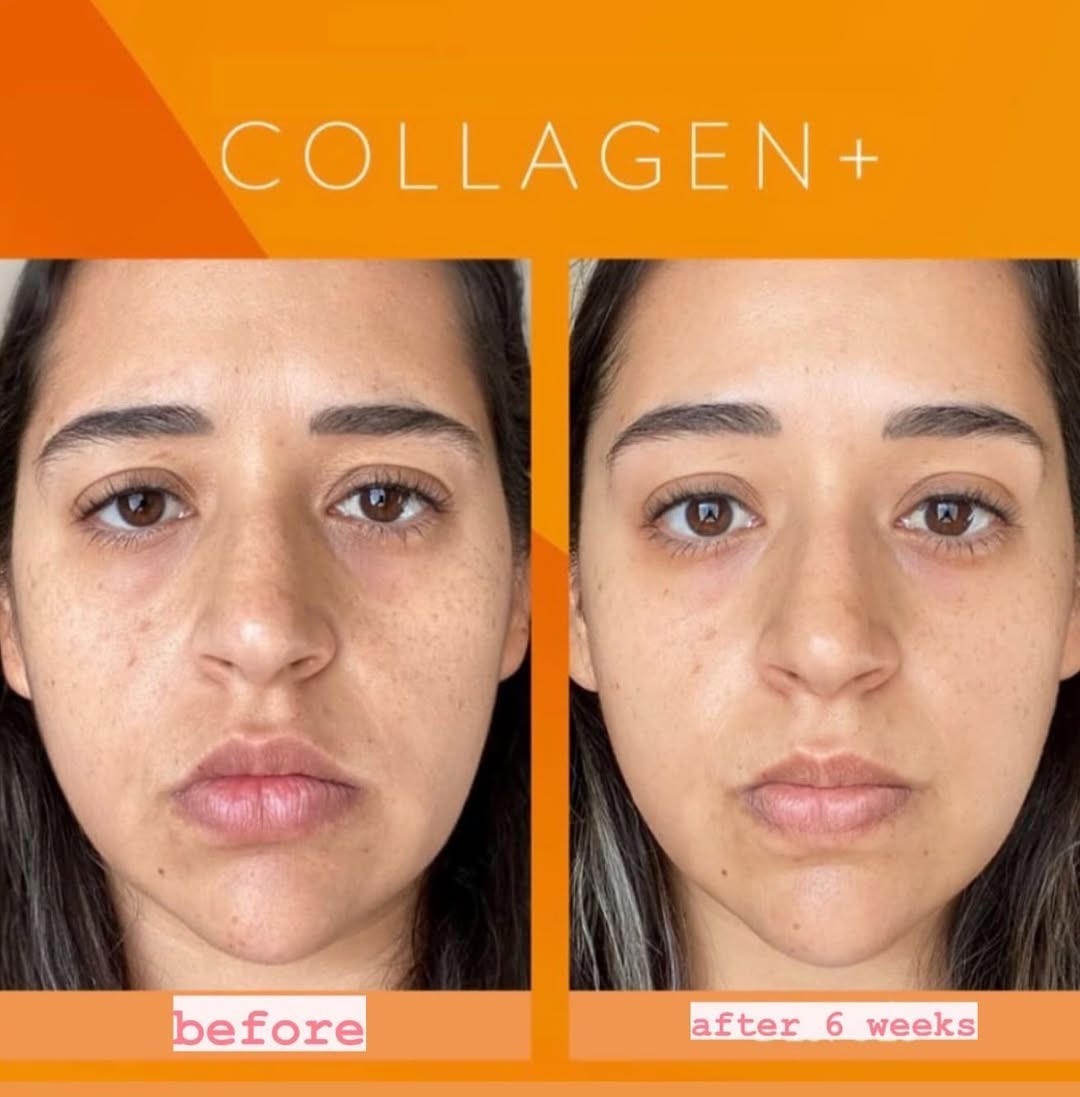imgi_5_Our-blend-of-Antioxidants_-Ceramides-and-Collagen-Peptides-offers___Helps-support-collagen-and-elastin-formation__Supports-skin-hydration-and-healthy-moistu