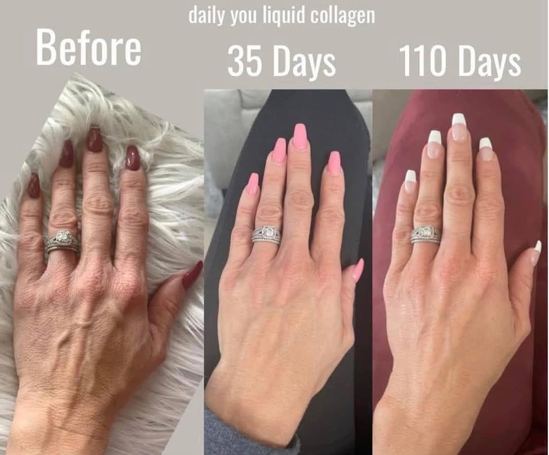 imgi_6_April-says_-___I-am-so-happy-my-hands-look-so-much-younger.-Even-in-my-20_s-my-hands-looked-old_-I-guess-because-I-wash-them-so-much.-__This-daily-you-liqui
